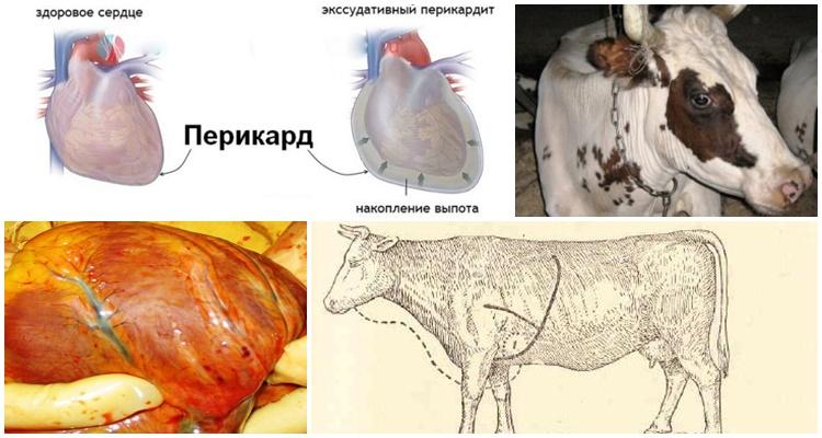 pericarditis traumática